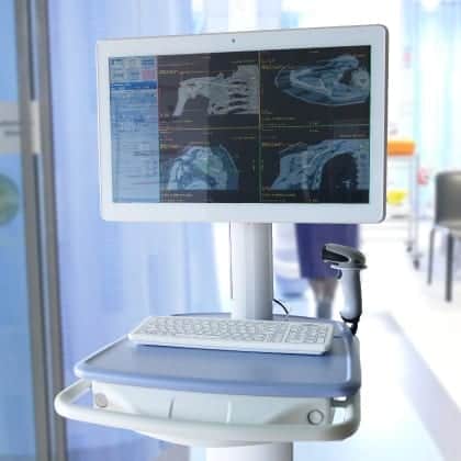 Agile Medical Medicow screen with keyboard and barcode scanner